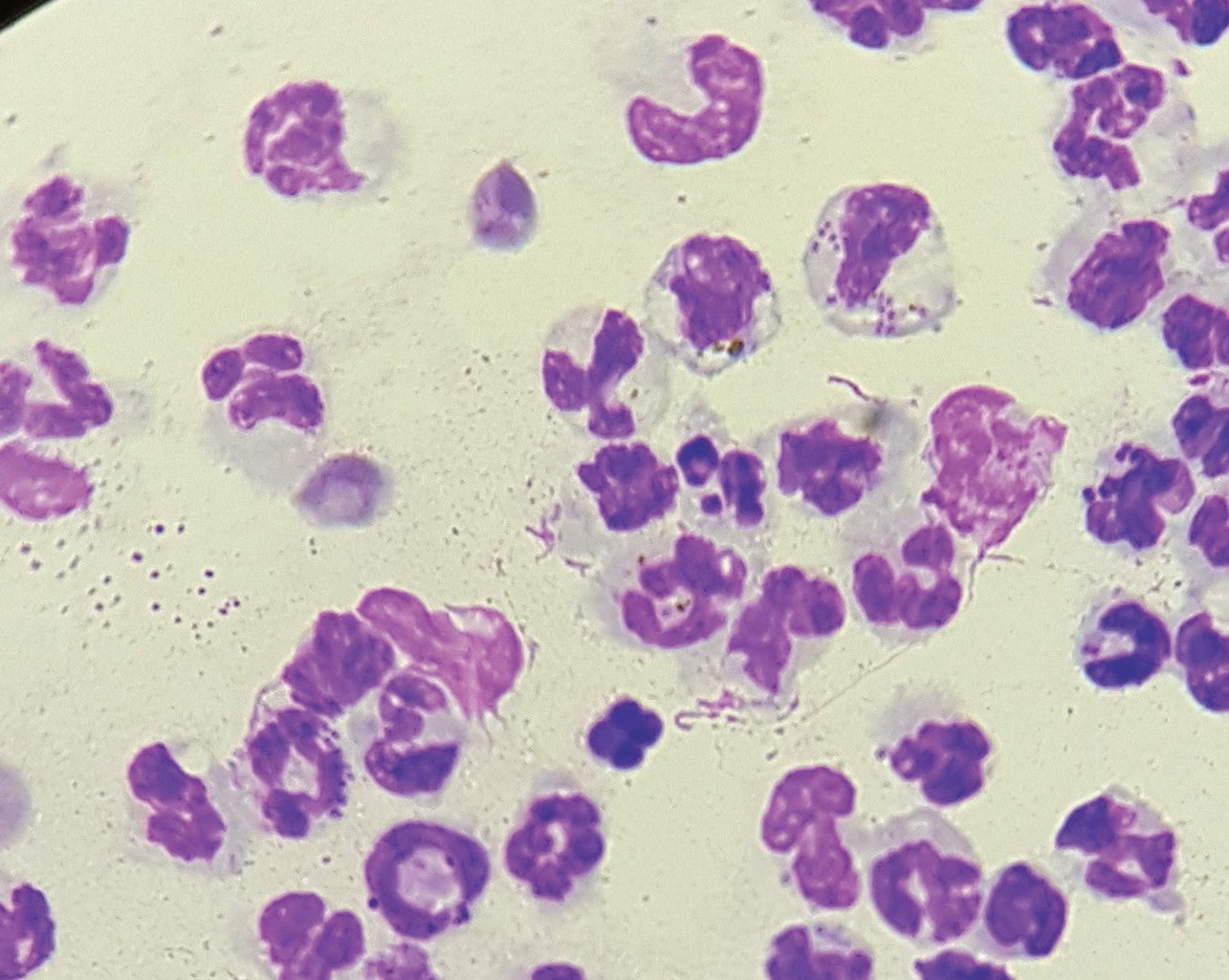 Superficial Pyoderma in Dogs Clinical Overview & Diagnosis